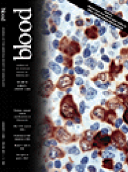 Blood 2002